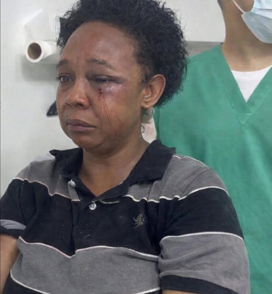 Hijo golpea a su madre en San Francisco de Macorís durante discusión por RD$5,000