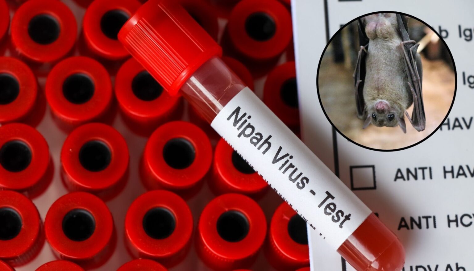 EE.UU. activa alertas sanitarias en aeropuertos por riesgo del Virus Nipah